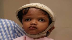 ଜଗାକୁ ଦରକାର ଦ୍ବିତୀୟ ଅପରେସନ୍